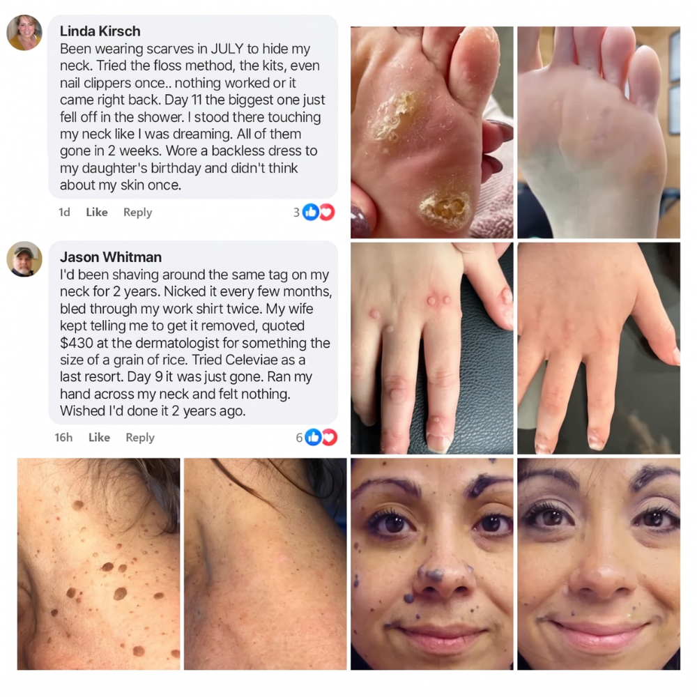 Celeviae™ Bump Renewal Spray